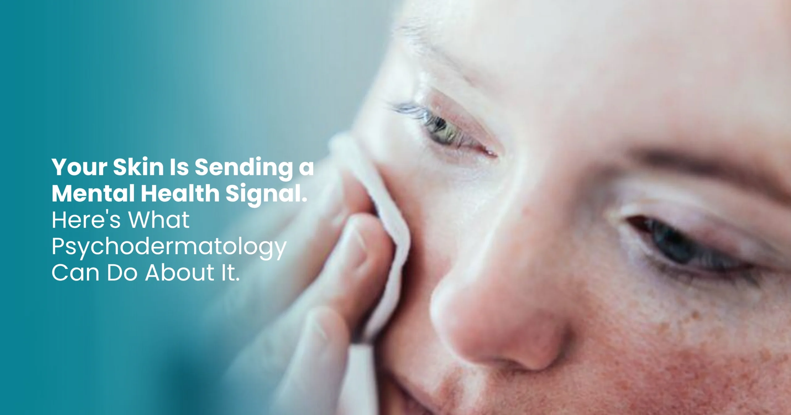 Skin Is Sending a Mental Health Signal